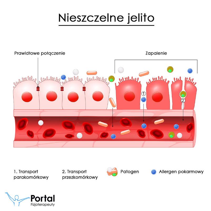 Objawy problemów z jelitami