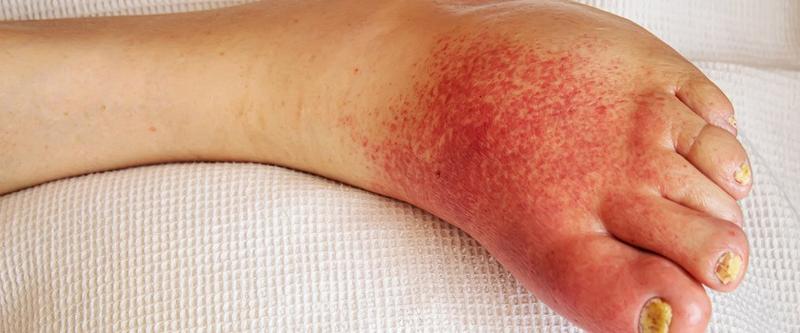 Wpływ środowiska na skórę