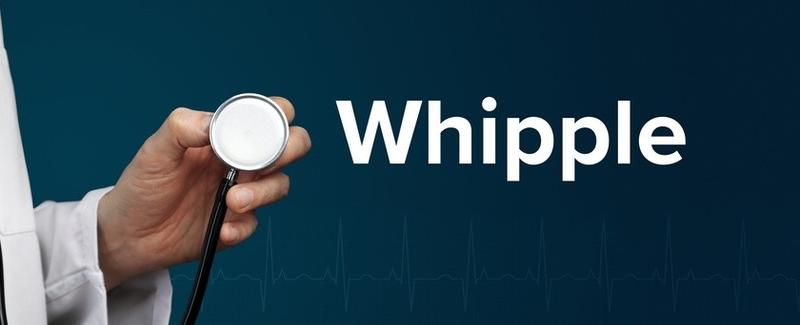 Leczenie choroby Whipple’a