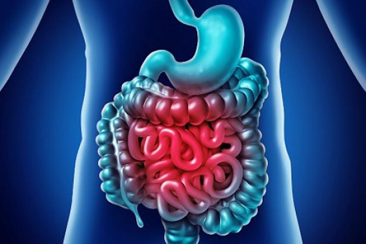 Przyczyny zespołu jelita drażliwego