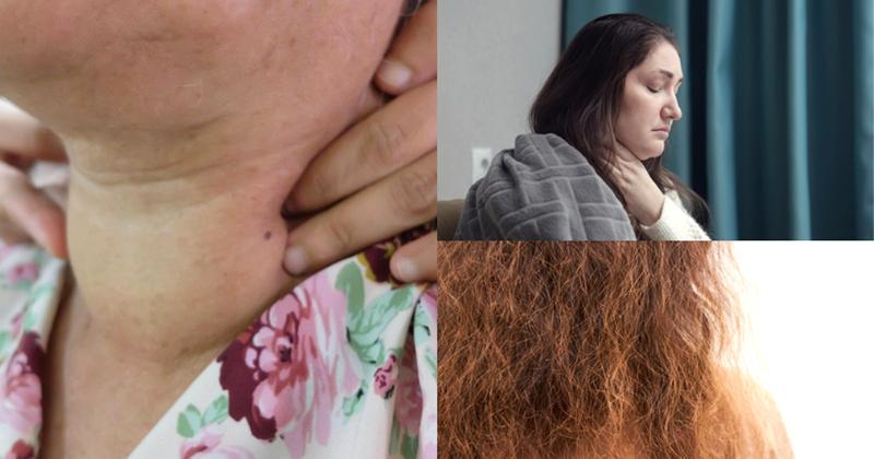 Objawy niedoboru jodu